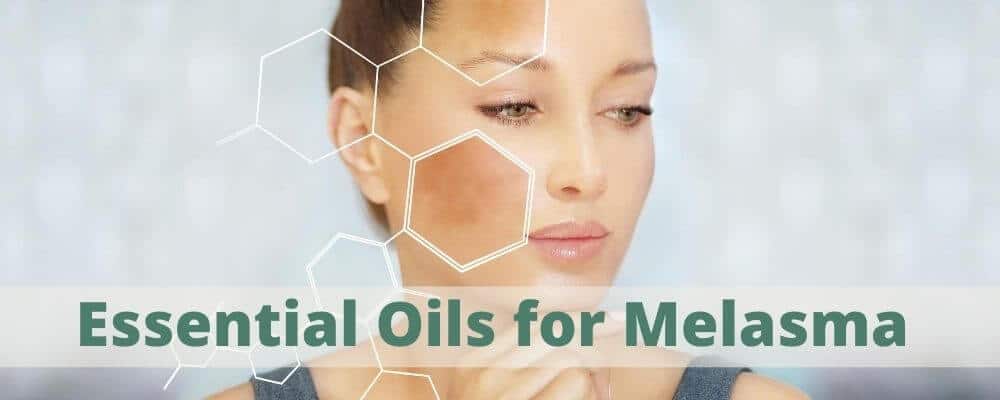 Essential-Oils-for-Melasma